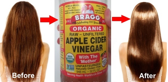 Apple Cider Vinegar Hair Rinse Benefits and Recipe – Roxie Cosmetics